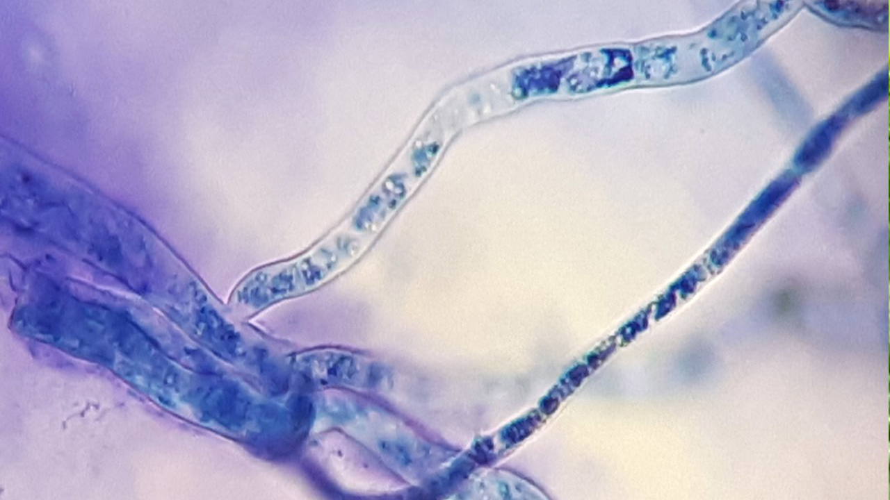 microorganismos-para-la-proteccion-biologica-de-cultivos